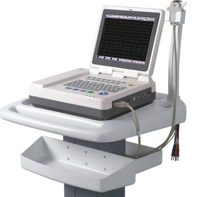 ECG